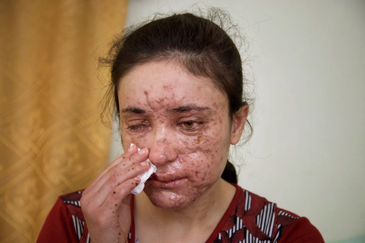 Islamiriigi käest põgenenud endine seksiori, 18-aastane Lamiya Aji Bashar
