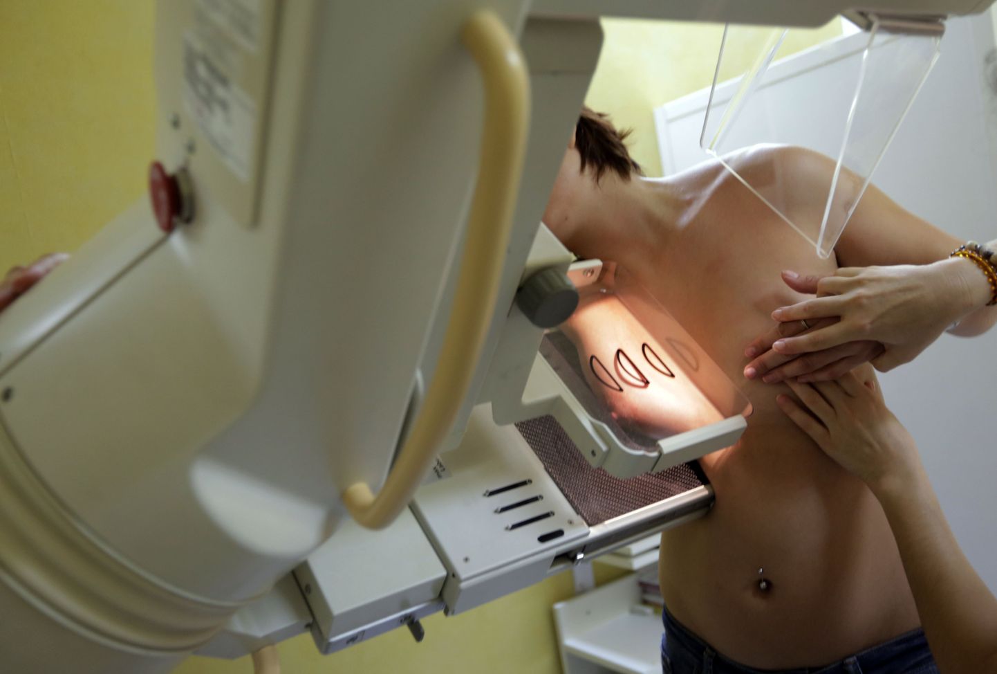 Mammograafia.
