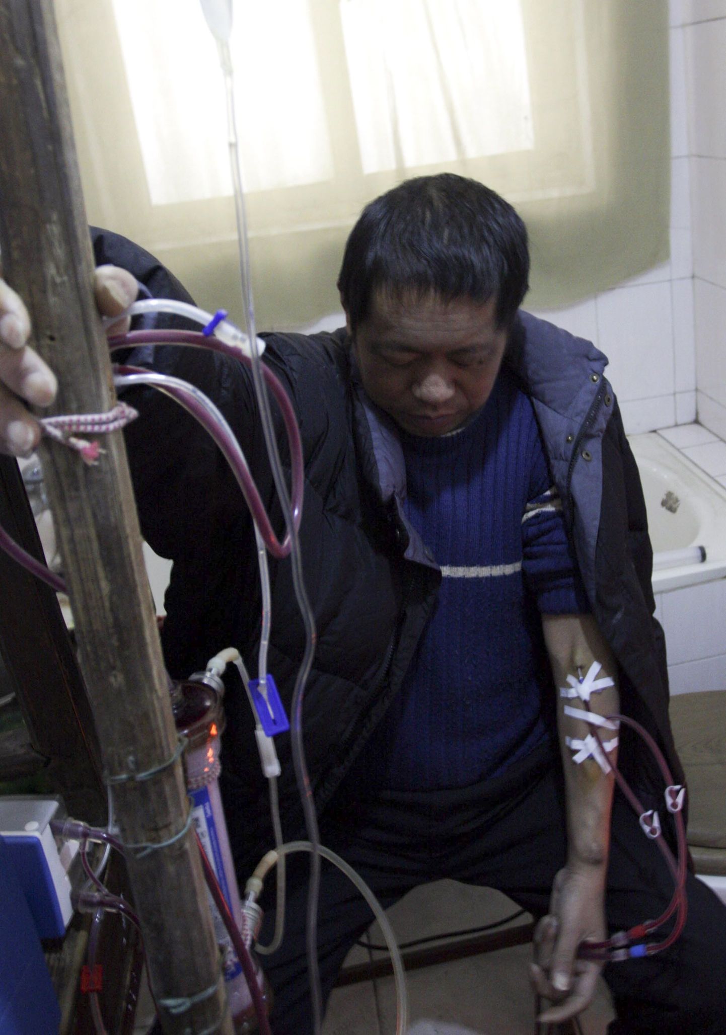 Hiinlane Hu Songwen ja tema dialüüsi masin