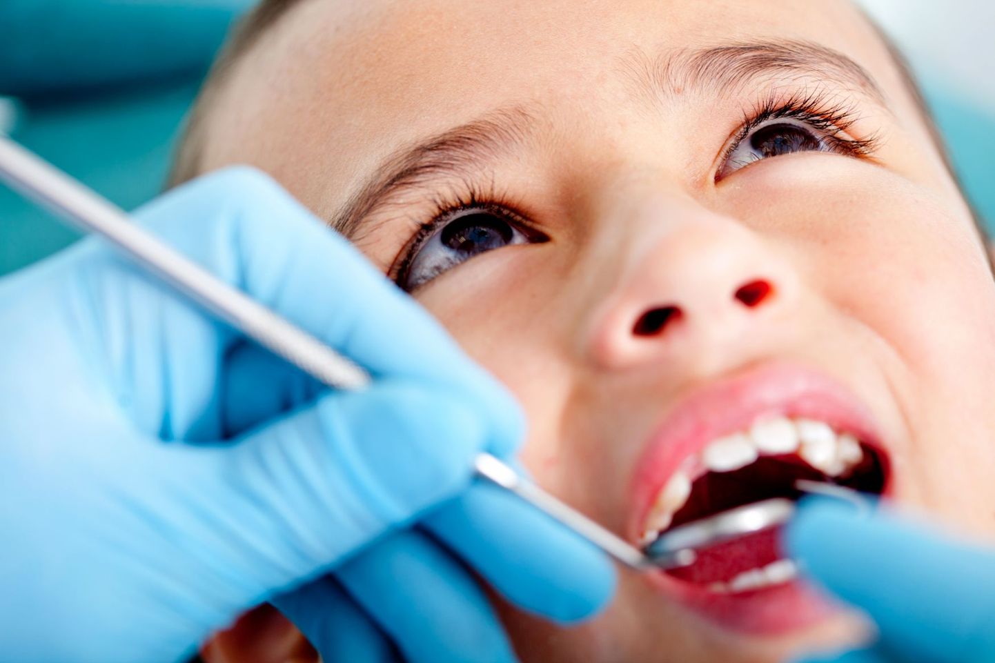 Eesti laste hammaste olukord on keskmine.
