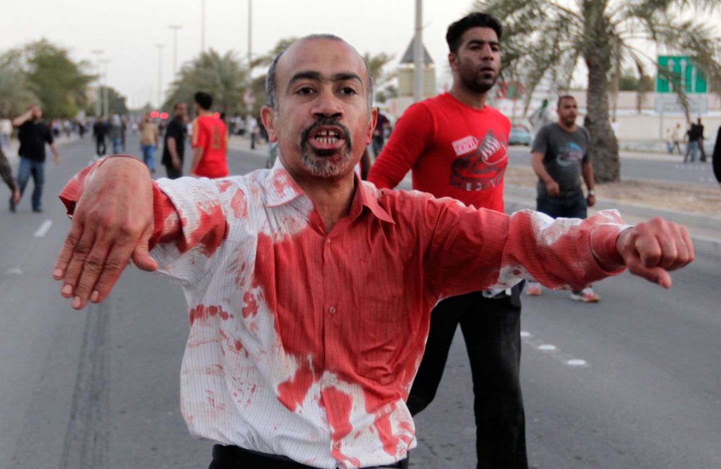 Verise särgiga Bahreini mees pärast seda, kui aitas haavata saanud meeleavaldajal haiglasse pääseda.