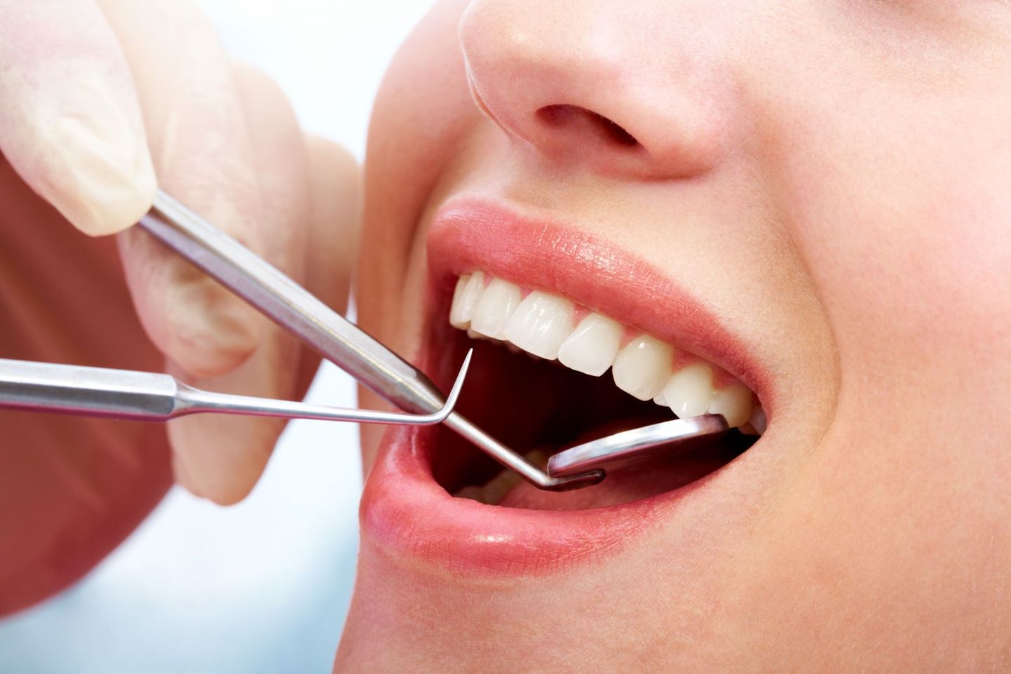 Eelmise aasta seisuga on Eestis 519 hambaraviteenust pakkuvat asutust.