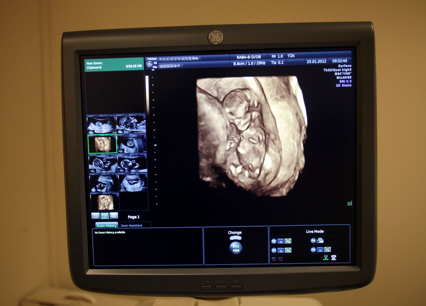 Pildil TÜ naistekliiniku ultraheli aparaat.