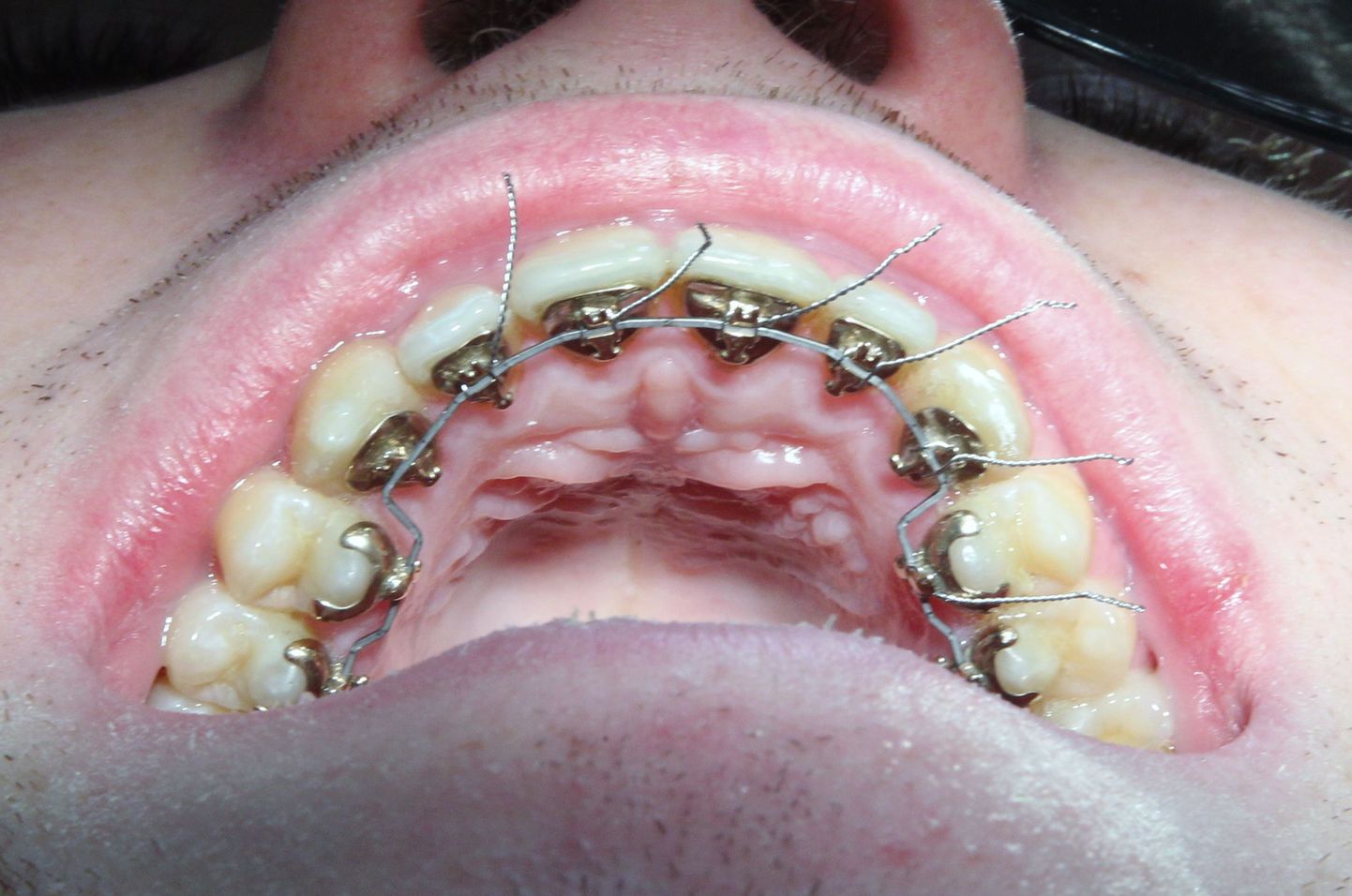 Täna vaatavad hambaarstid hea õnne korral ka tasuta suhu ja ütlevad, kuidas edasi toimida.