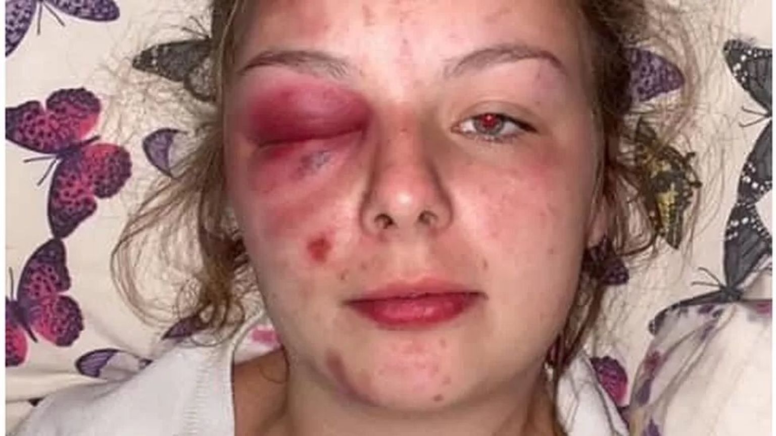 Расследование показало, что Элеанор Уильямс нанесла себе увечья сама, купив для этого молоток в супермаркете