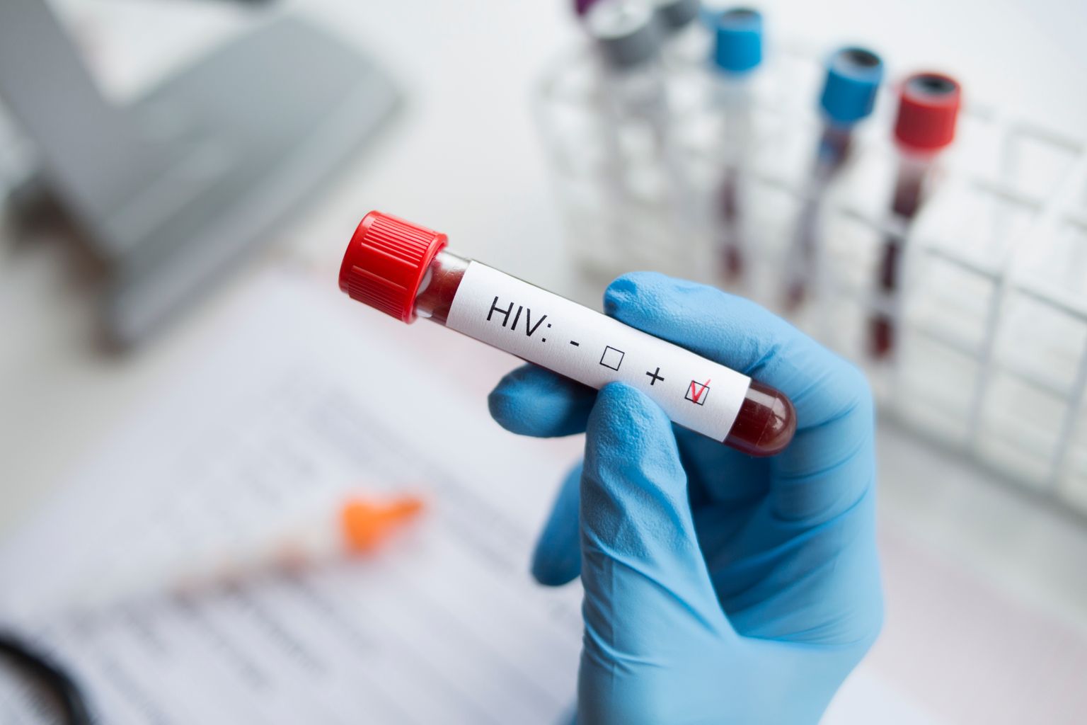 HIV tegevuskava eesmärke viivad suures osas ellu Eesti Haigekassa ja terviseamet.