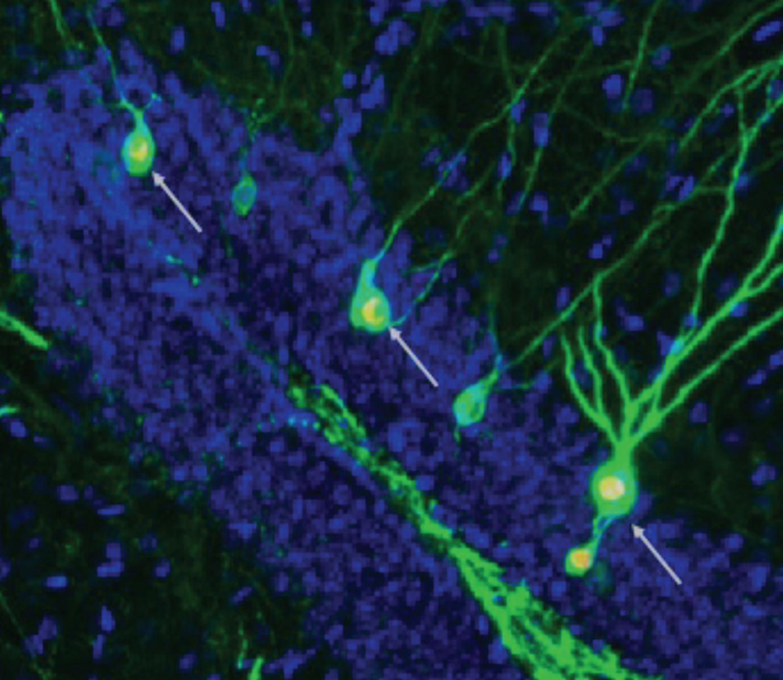 Uuring näitab, et neurogeneesi suurendamine suurendab ka äsja moodustunud neuronite arvu, mis on seotud mälestuste (nooltega näidatud) salvestamisega ja meenutamisega Alzheimeri tõvega hiirte hipokampuses.