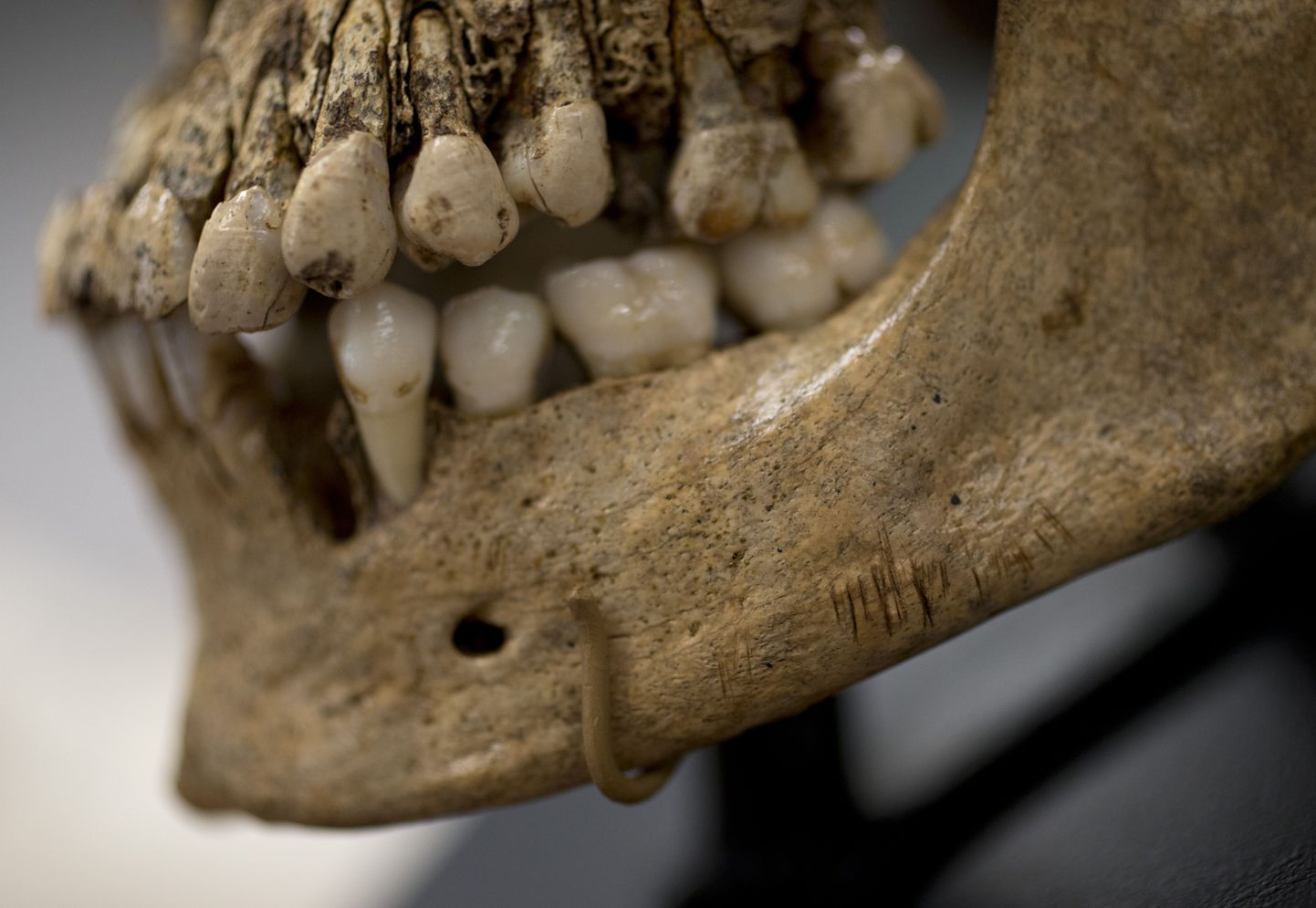 Kannibalismi jäljed «Jamestowni Jane’ina» tuntud skeletist. Tema lõualuul olevad noajäljed on teadlaste sõnul selge näide Ameerika varaste kolonistide kannibalismist.