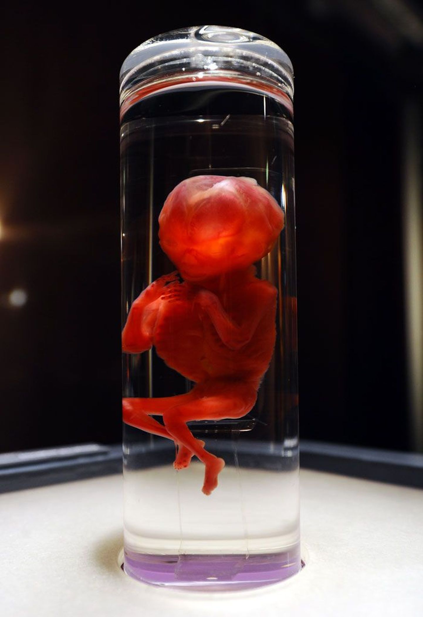 Эмбрион. Снимок иллюстративный