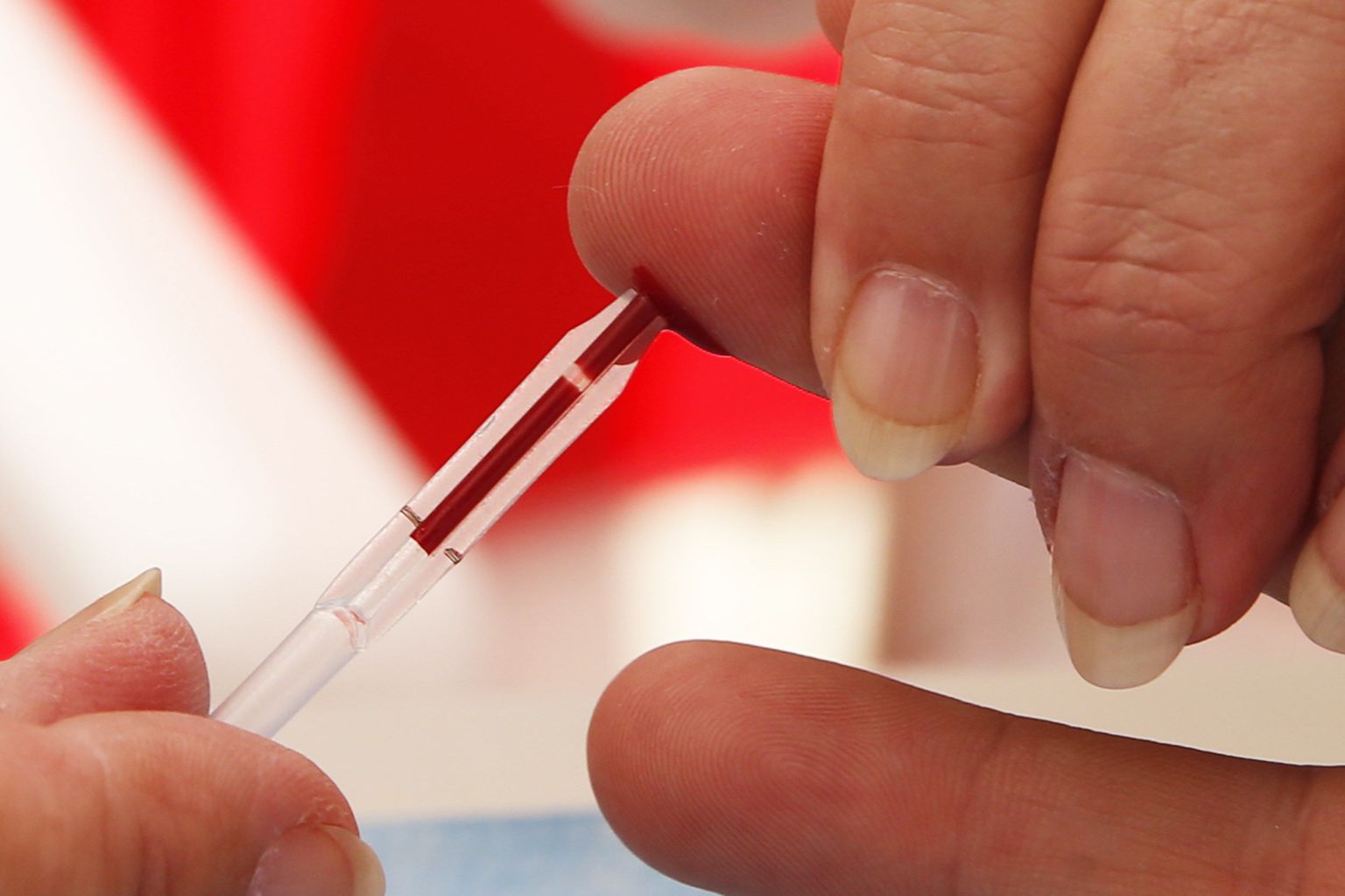 Desinfitseerimisvahendi asemel seepi kasutanud haigla kutsub patsiendid HIV-testi tegema.