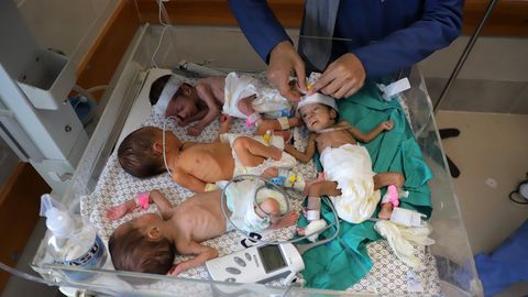 Al-Shifa haigla enneaegsete beebide elu ripub juuksekarva otsas