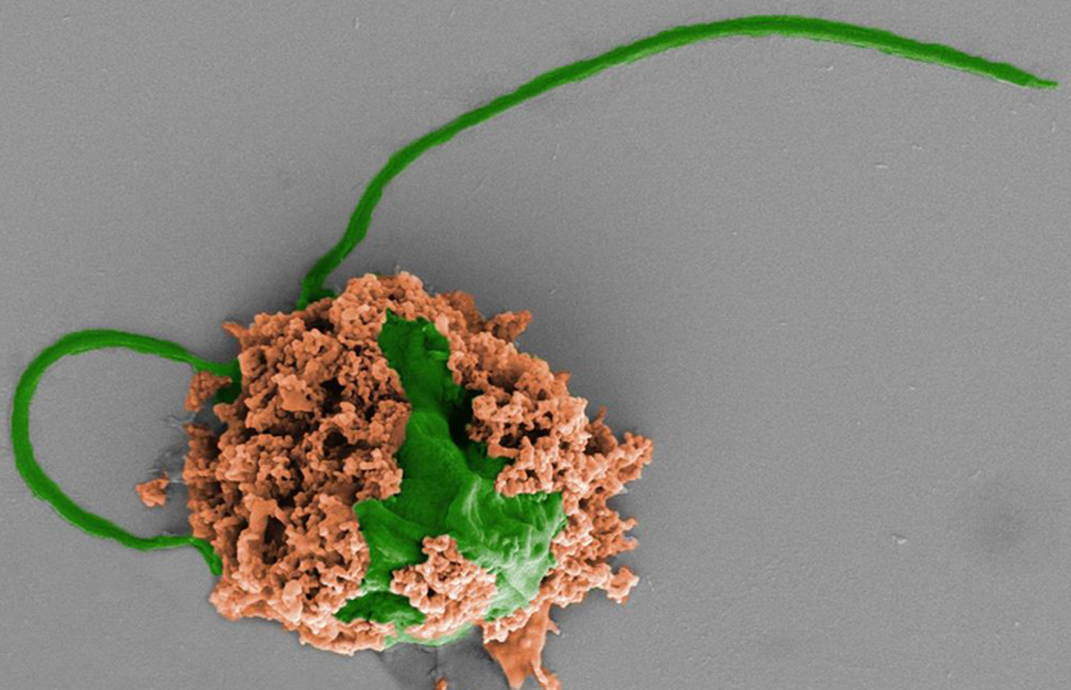 Kopsupõletiku vastu võitlev mikrorobot on valmistatud vetikarakust (roheline), mis on kaetud biolagunevatest polümeeridest nanoosakestega (pruun). Nanoosakesed sisaldavad antibiootikume ja on kaetud neutrofiilide rakumembraanidega.