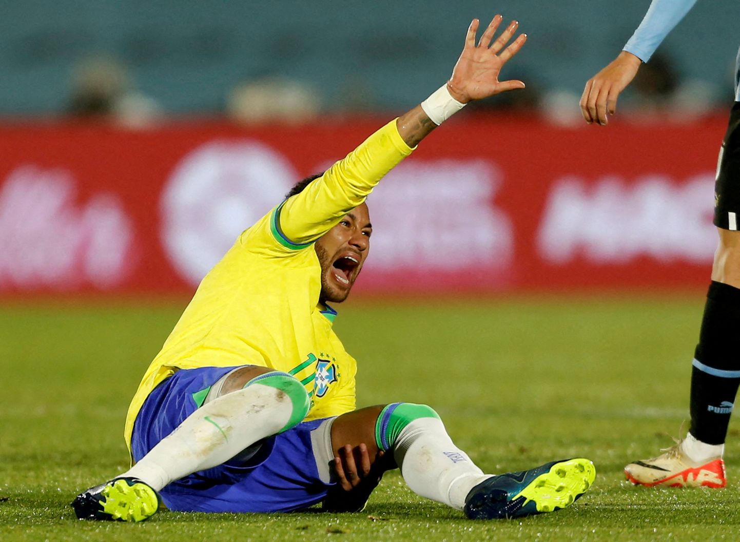 Brasiilia koondise eest mängides vigastada saanud Neymar vajab operatsiooni.