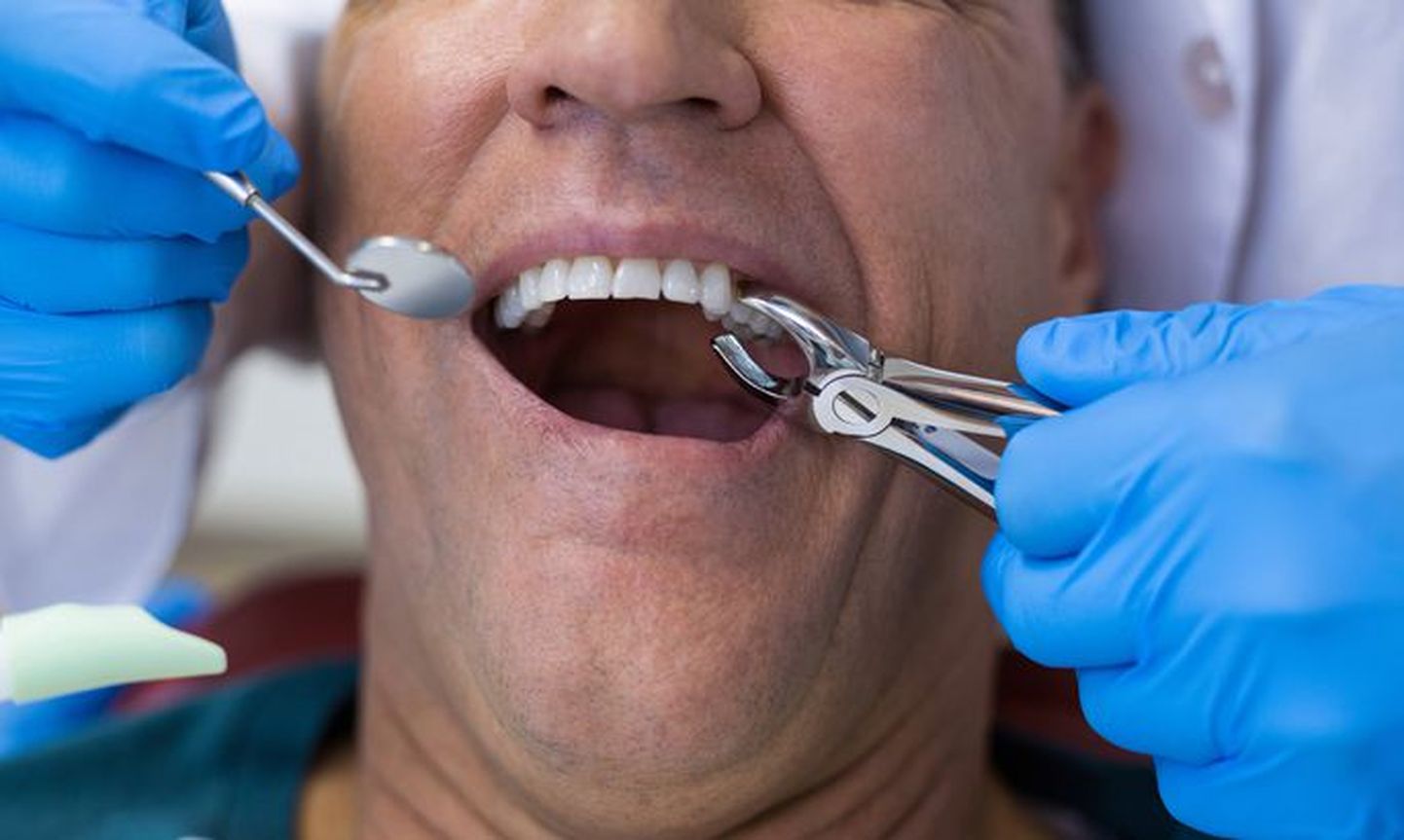 Проверять состояние зубов нужно минимум раз в год, если проблему запустить, позжее ее решение окажется намного затратнее.