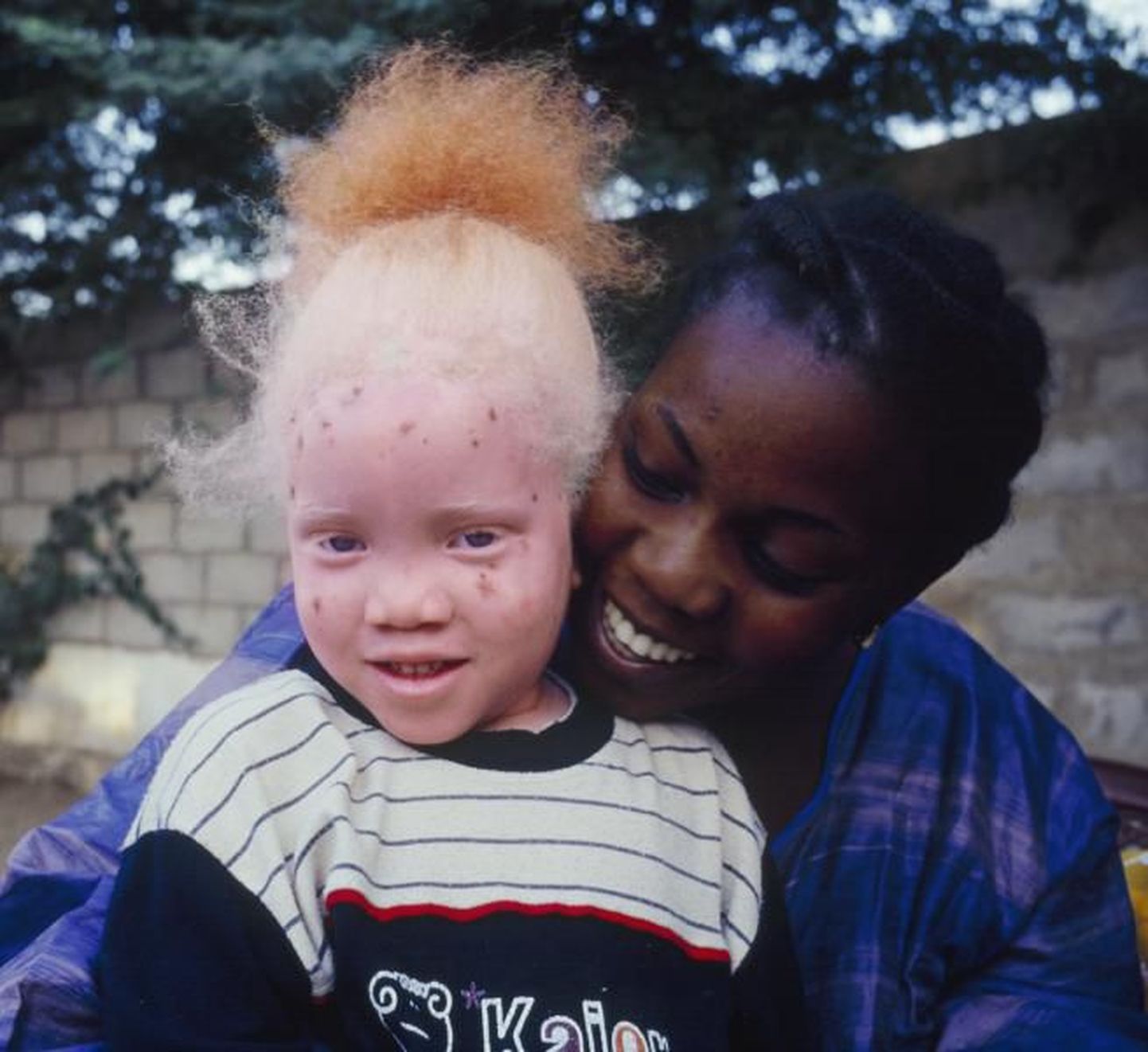 Negriidne ema koos albiinost tütrega