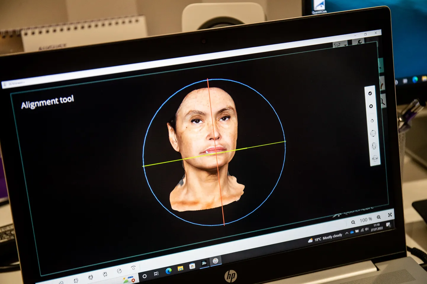 Система 3D LifeViz Infinity позволяет не только рассказать о предлагаемых процедурах, но и, проведя быструю и простую съемку, продемонстрировать их на примере клиента