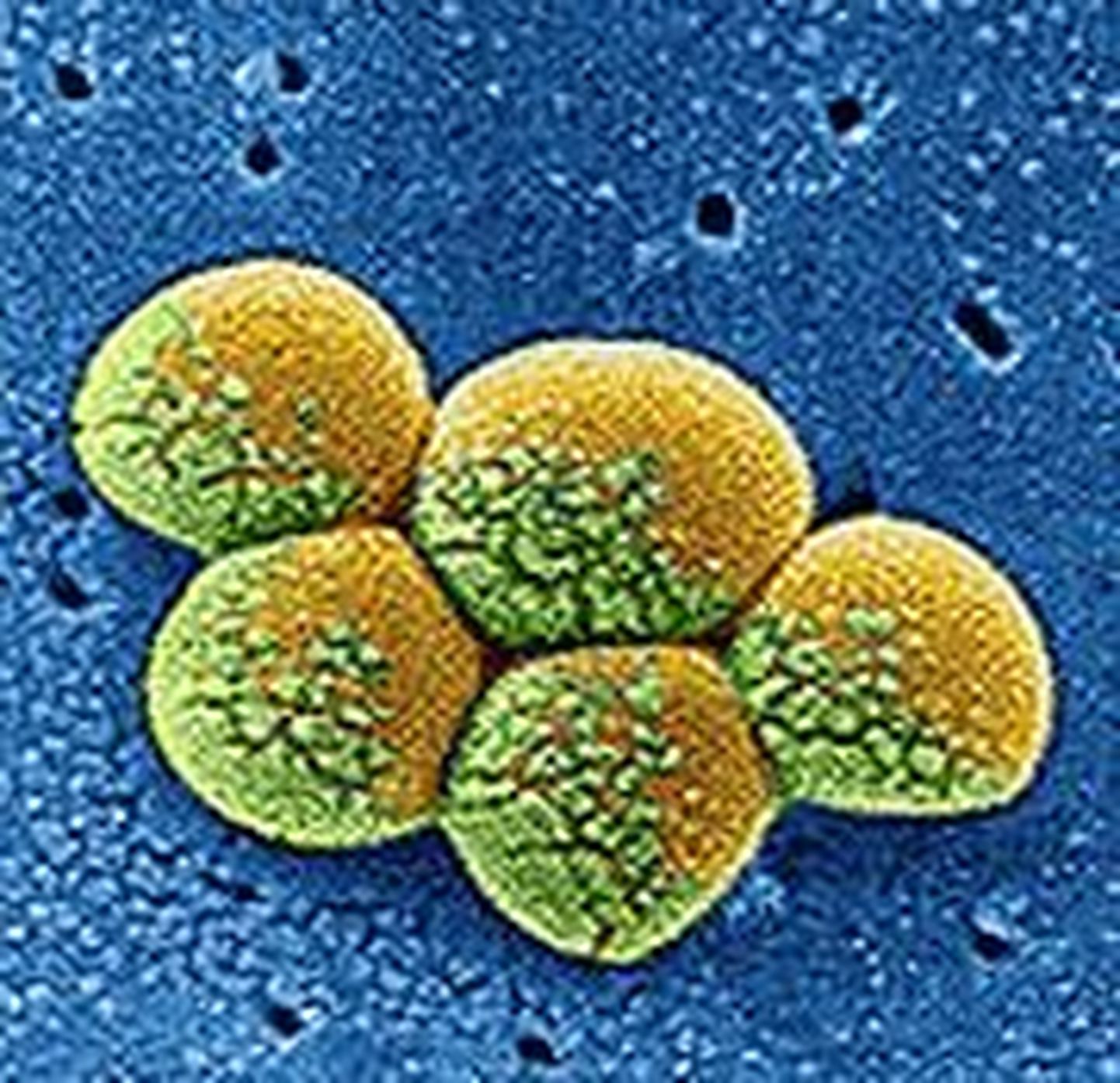 MRSA ehk metitsilliinile resistentne Staphylococcus aureus.