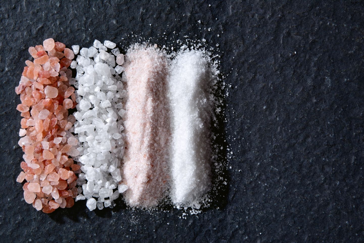 Liiga palju soola häirib aju tööd.