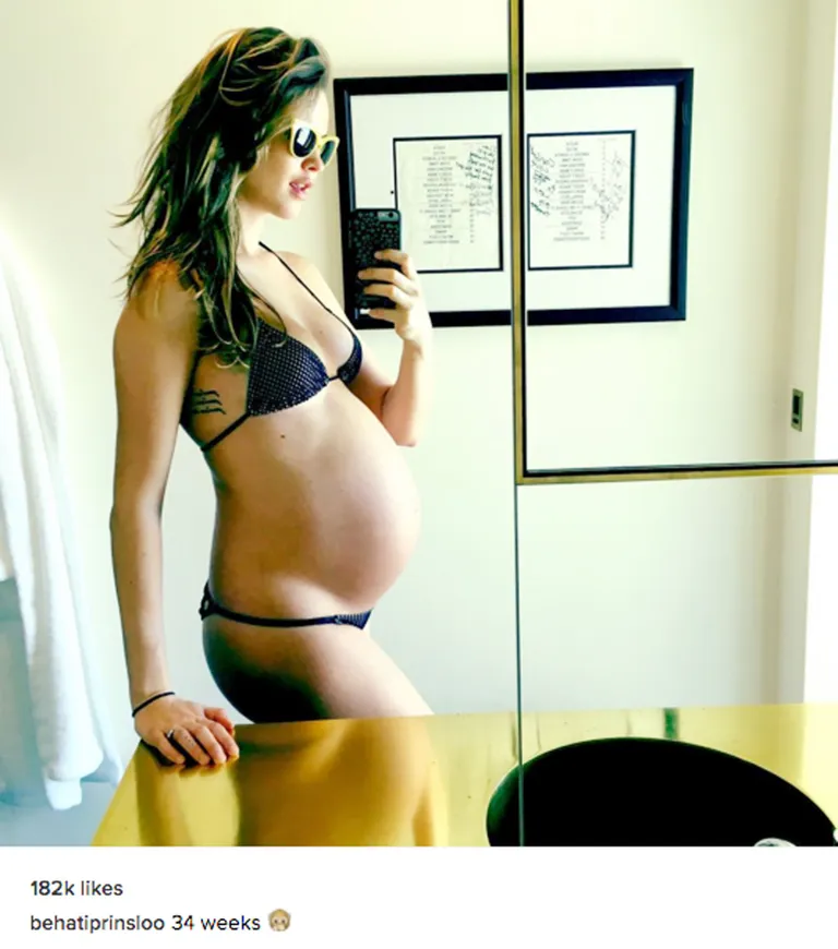 Behati Prinsloo / Scanpix