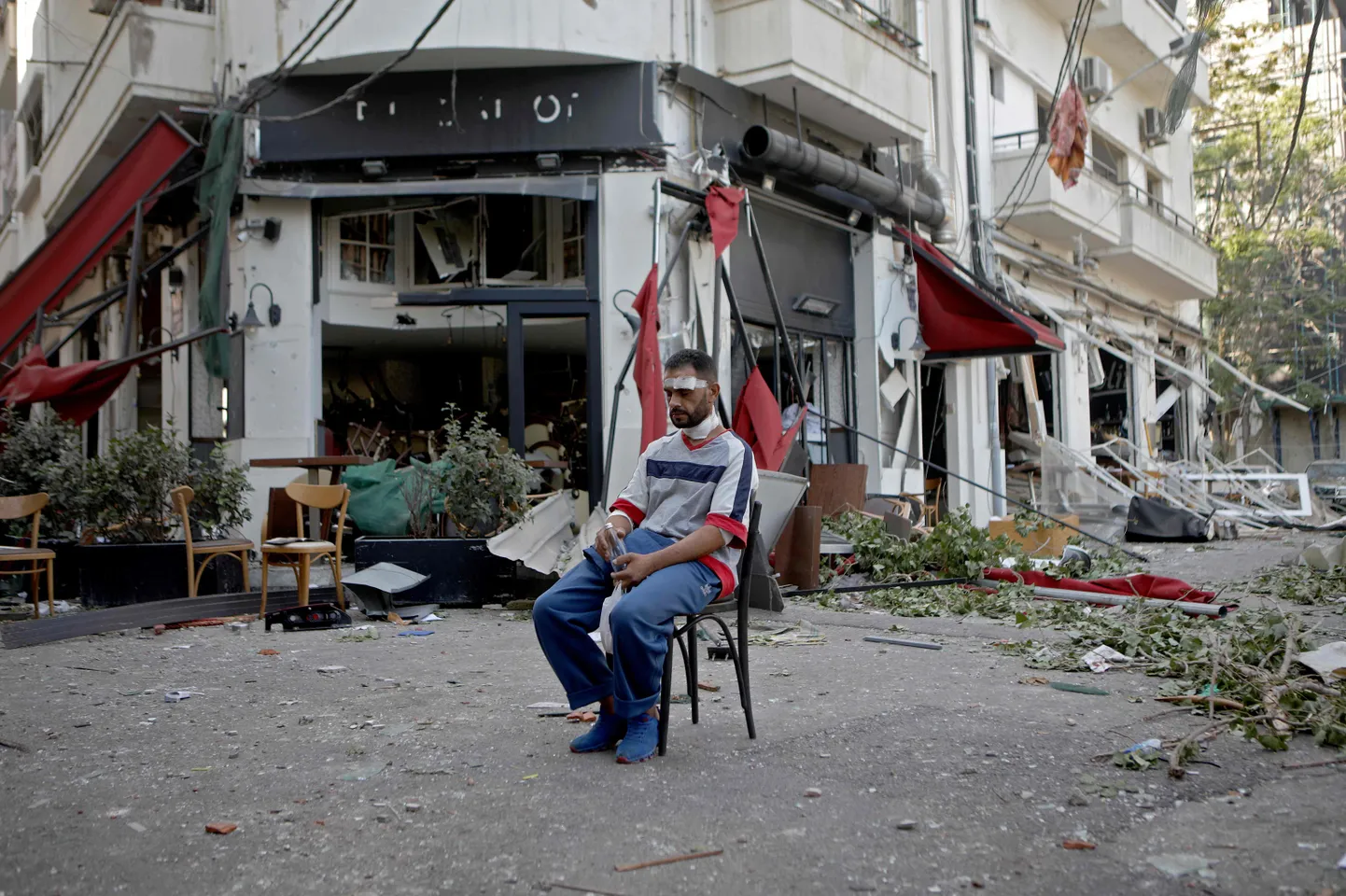 Раненый житель Бейрута сидит около ресторана в частично разрушенном взрывом пригороде ливанской столицы.