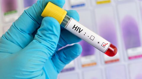 В Эстонии зафиксирован резкий скачок заболеваемости ВИЧ