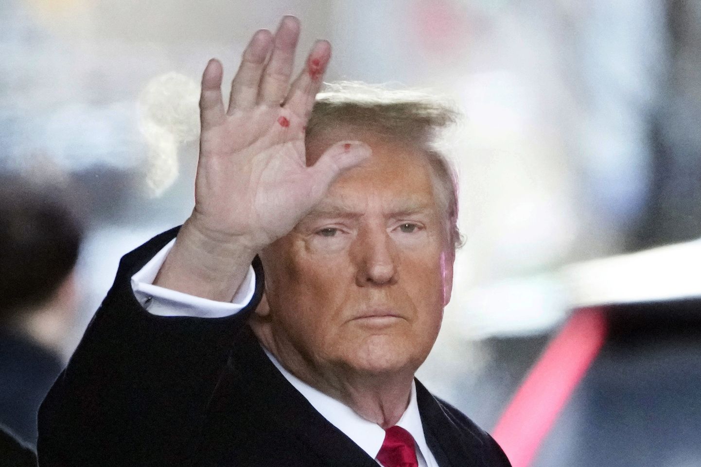 Трамп с красными пятнами на руке