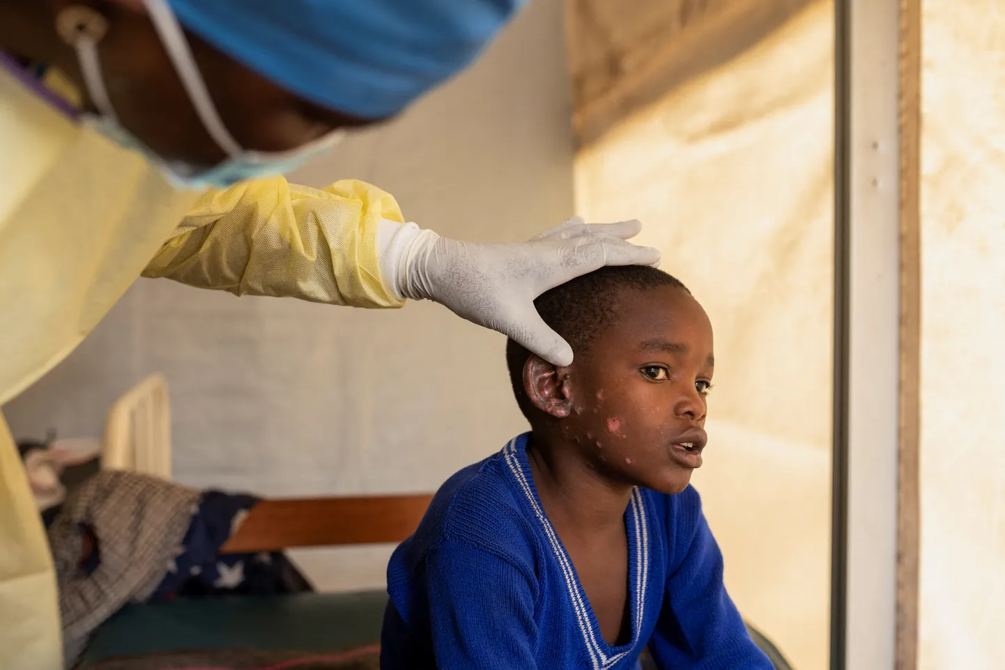 Uganda teatas kahest esimesest m-rõugete juhtumist.