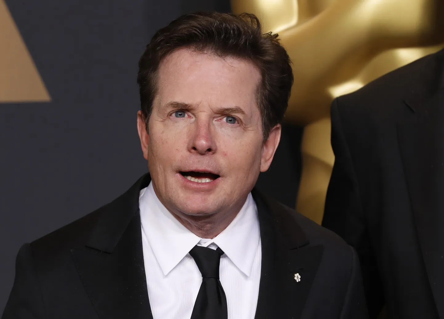 Michael J. Fox.