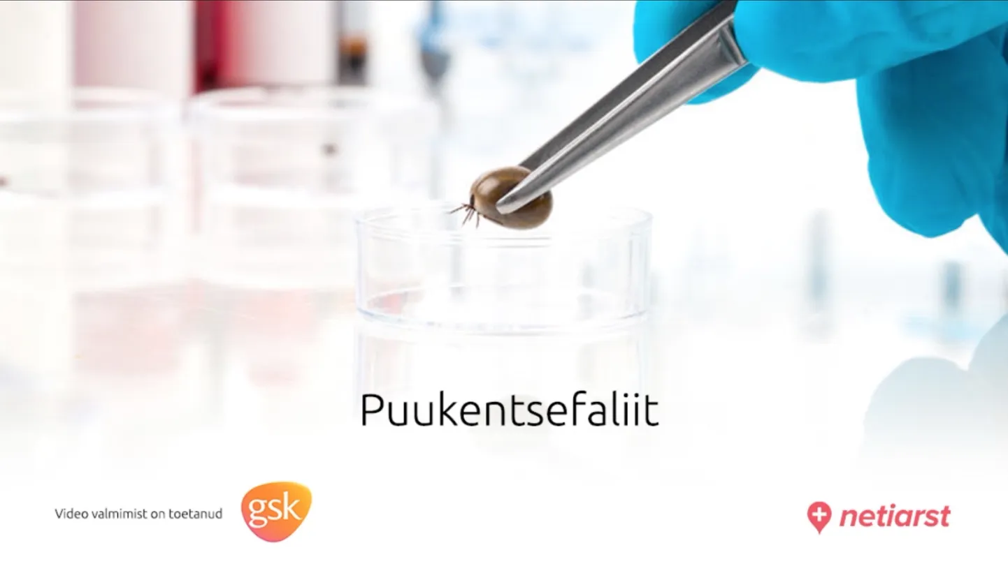 Puukentsefaliit