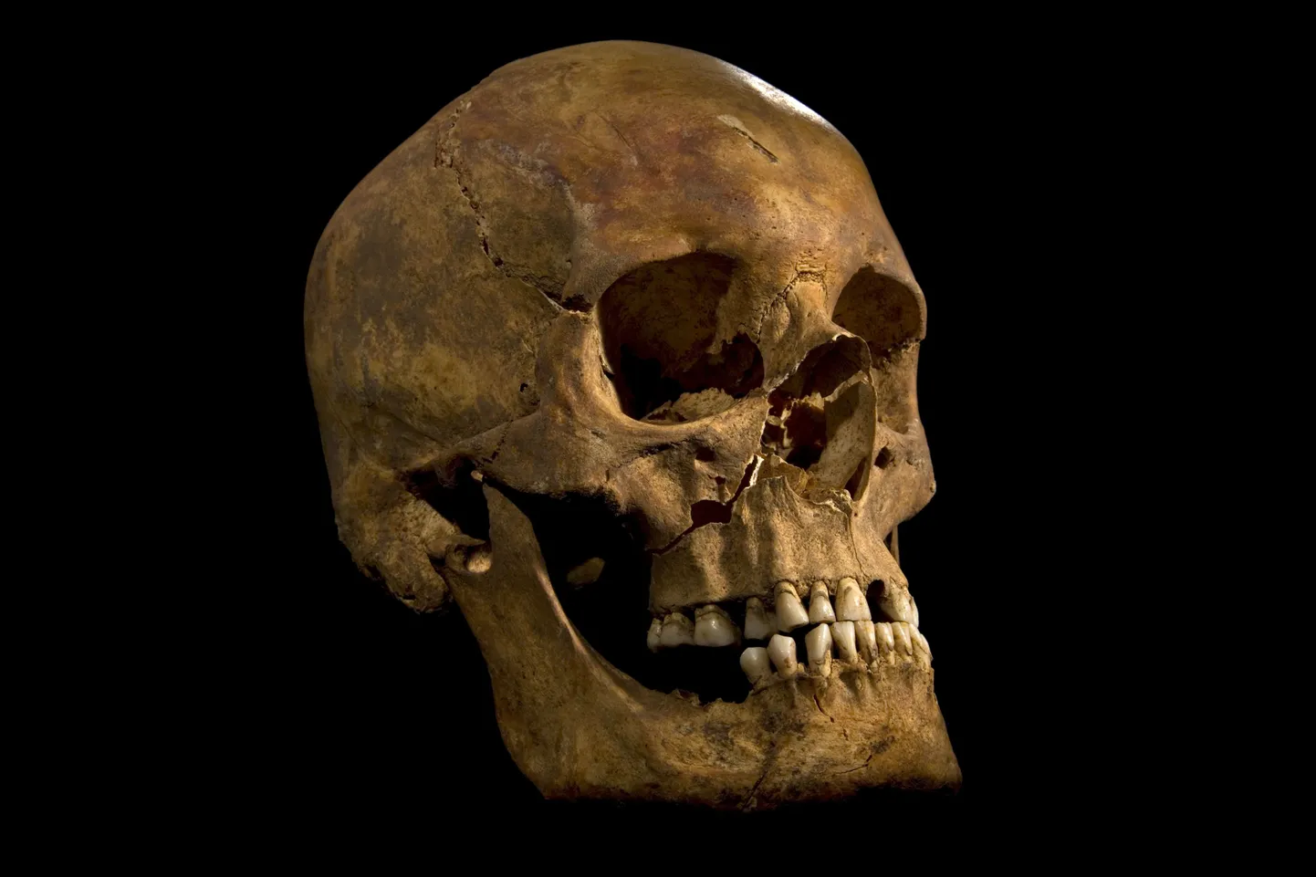 Oletatavalt Richard III kuuluv kolju