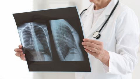 Stradiņos pacients inficējies ar slimnīcā konstatēto antibiotiku rezistento baktēriju