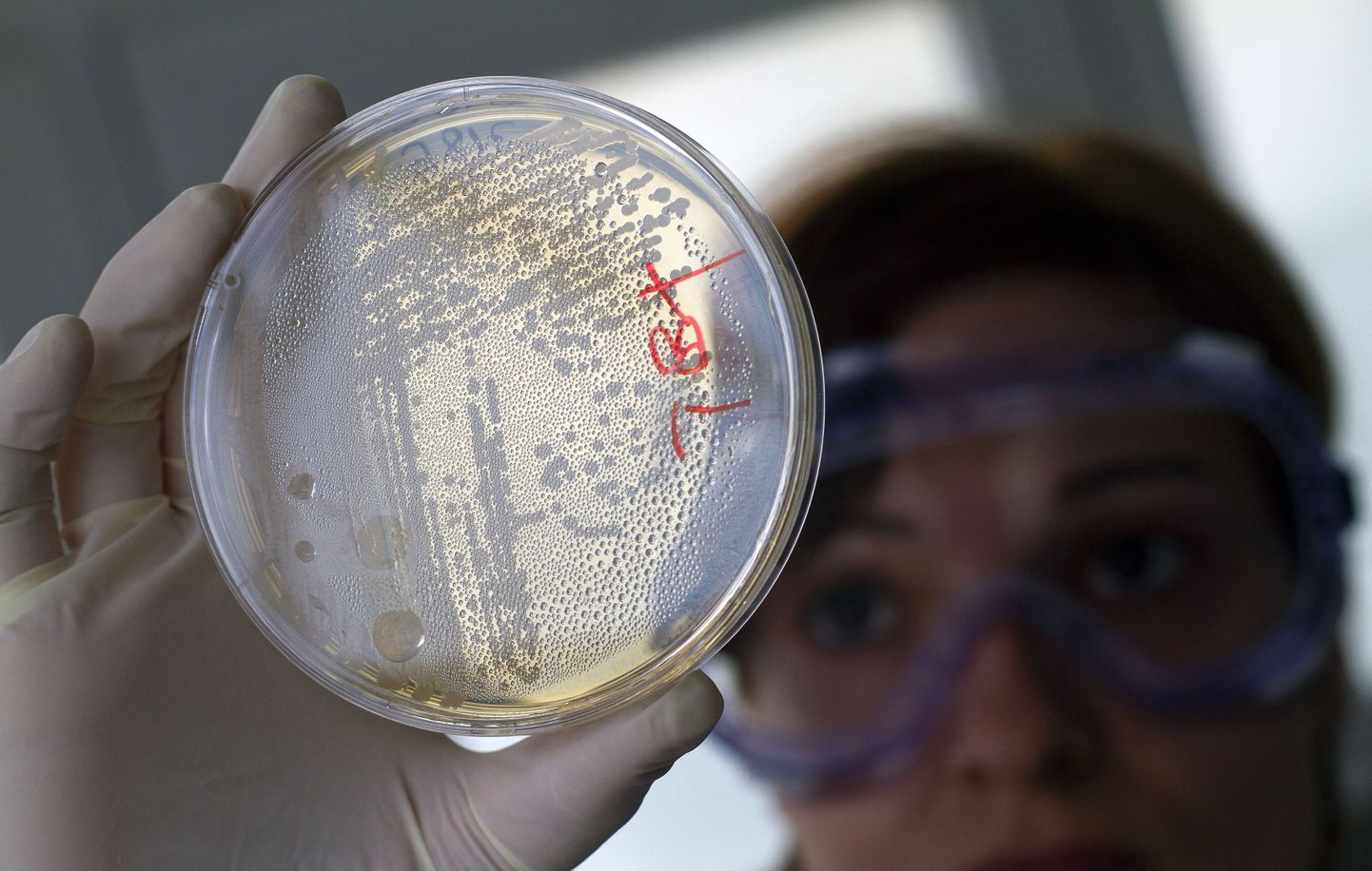 USA-s kahtlustatakse EHEC-kolibakteri tõttu haigestumist