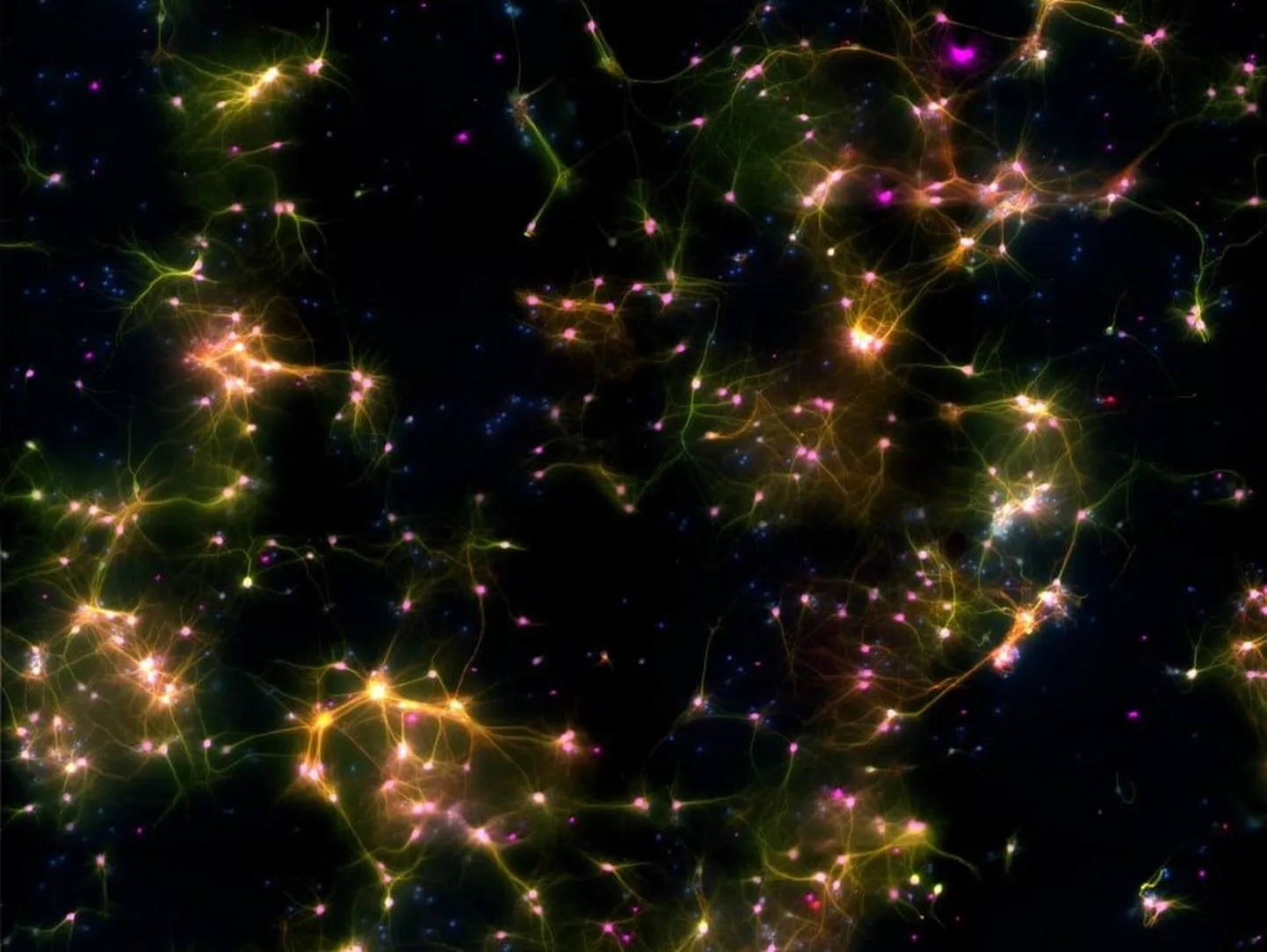Nii ilus näeb välja ajurakkuide loodud muster kiibis, mis jätab õppides kõik meelde. Inimese ajurakud märgistati helendava ainega