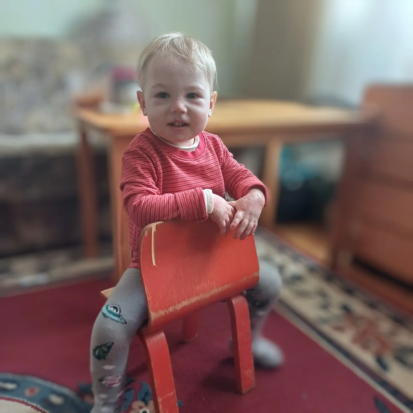 Kaheaastane Myroslav põeb üliharuldast ja -rasket haigust, bulloosset epidermolüüsi: tema nahk on kaetud villidega, millest saavad purunedes valusad haavad.