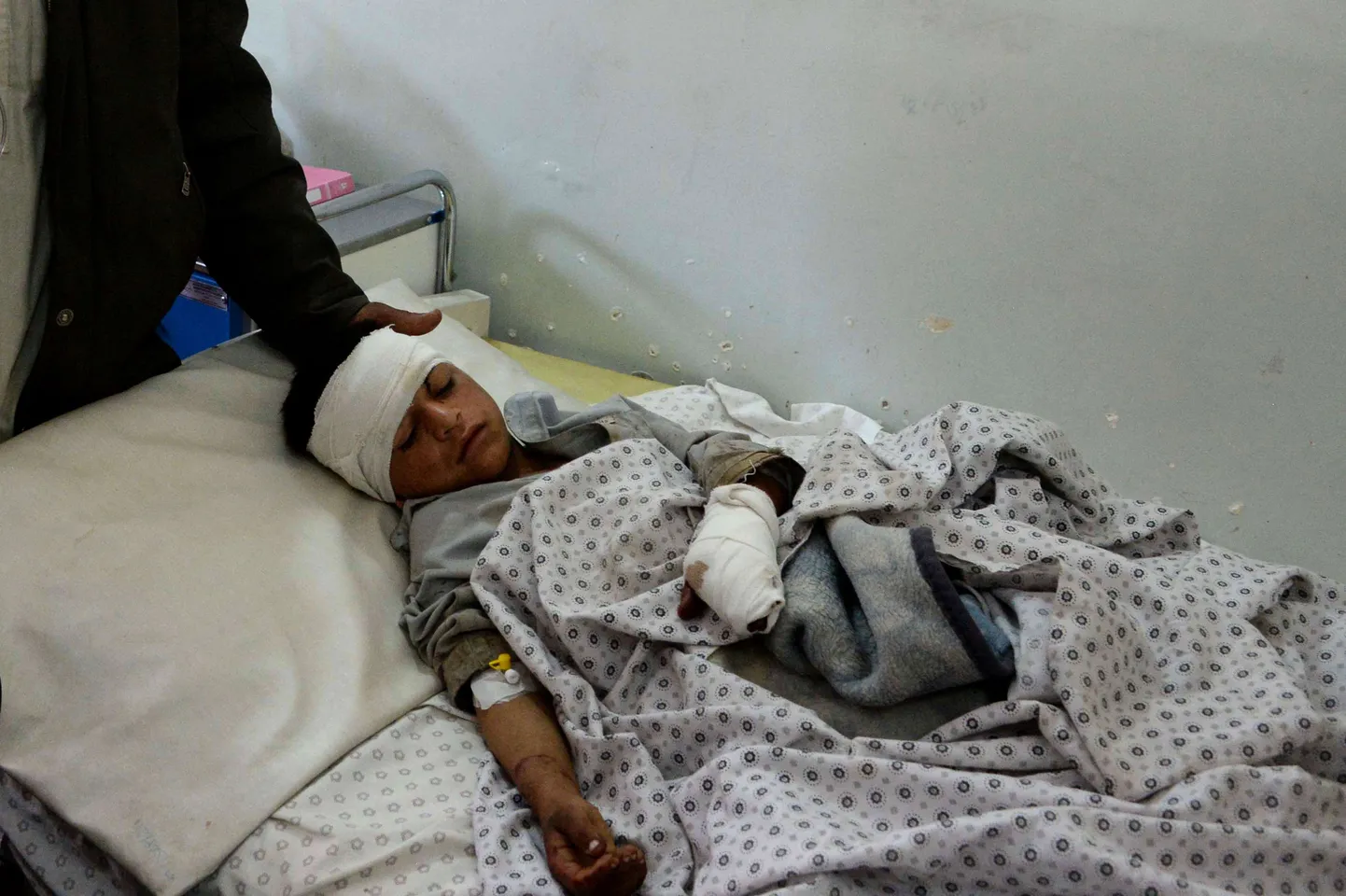 Enesetapuplahvatuses viga saanud afgaani poiss Kunari provintsi haiglas.