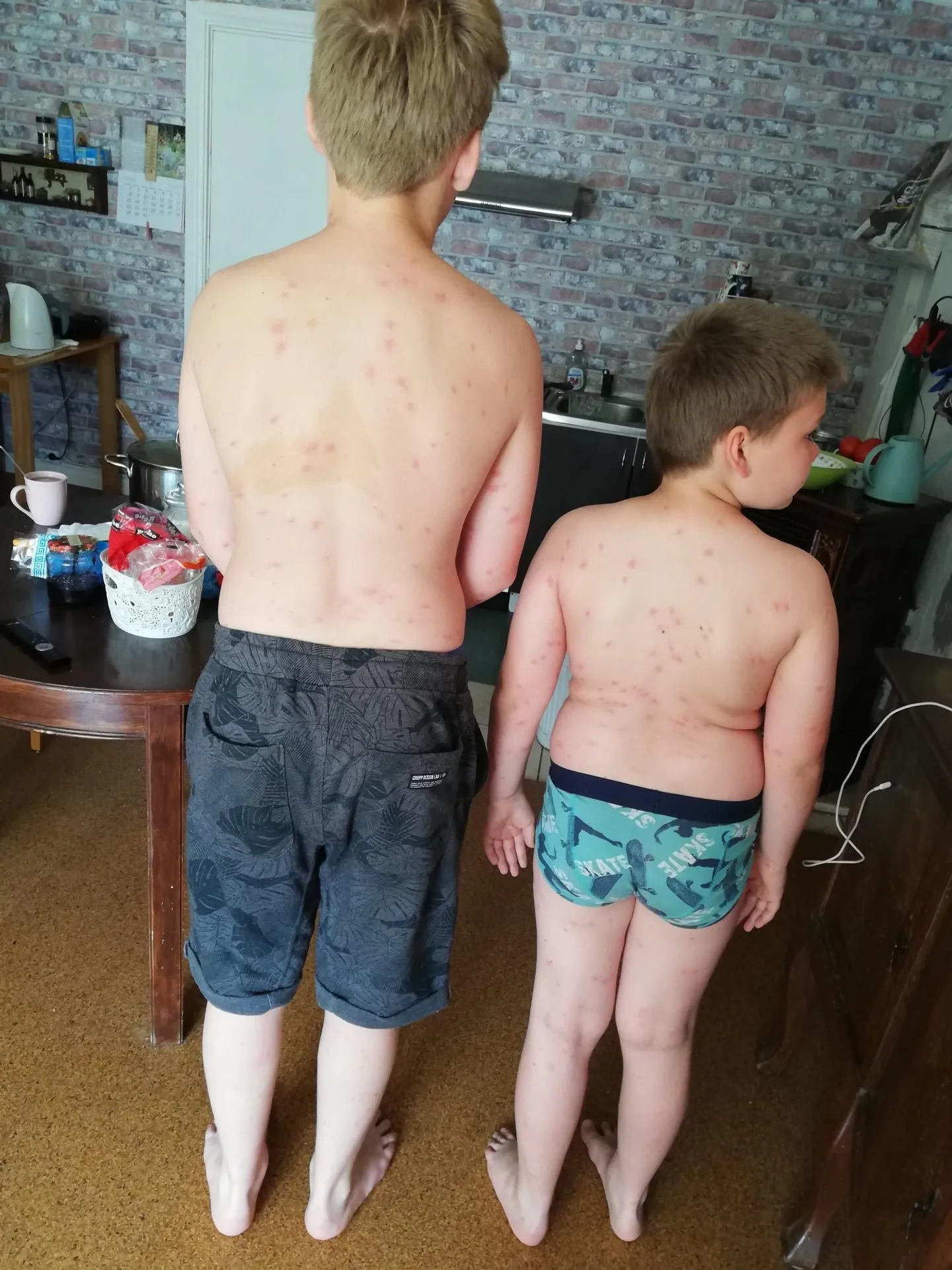 Lääneranna vallas Koonga lähistel Pikaveres Saari tiigis ujumas käinud poistel tekkisid suvel pärast suplust nahale mädapunnid.