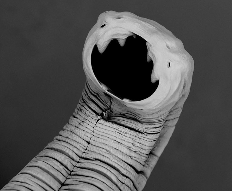 Necator americanus'el on pisikesed konksud, millega ta kinnitub inimese sooleseina külge