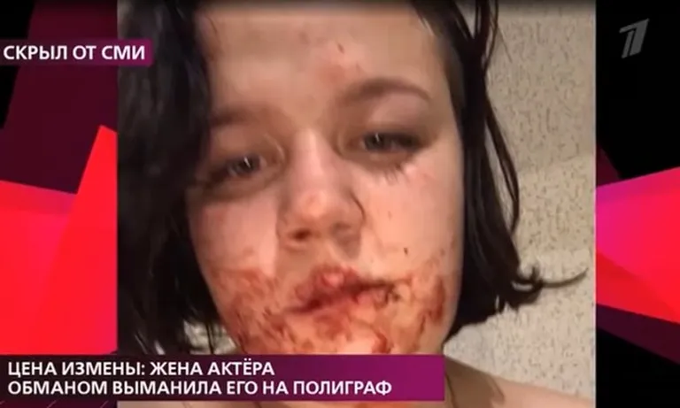 Фото статьи