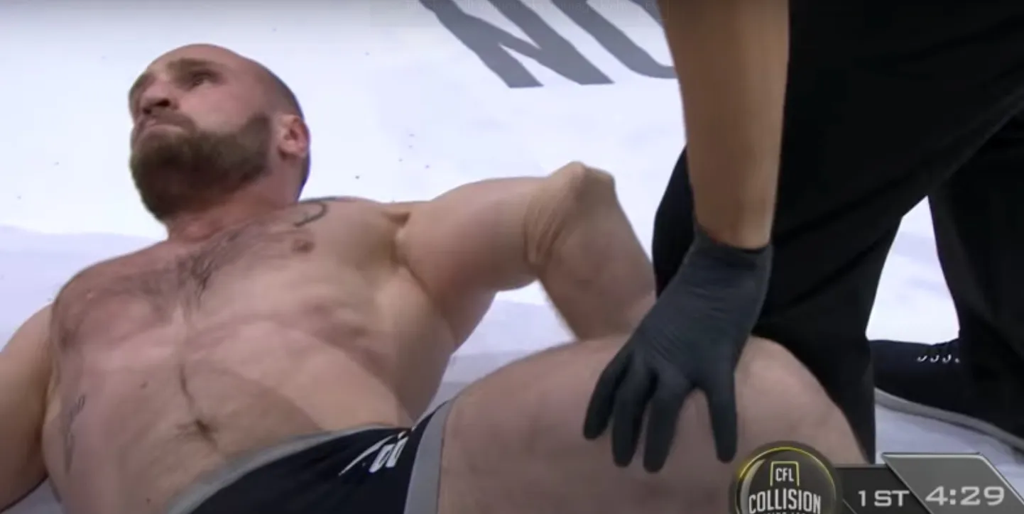 MMA võitleja kukkus ai-ai kui pahasti käe peale.