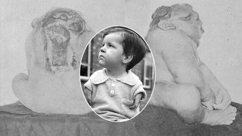 Kā rodas iedzimtas anomālijas? “Mātes iespaidu” teorija