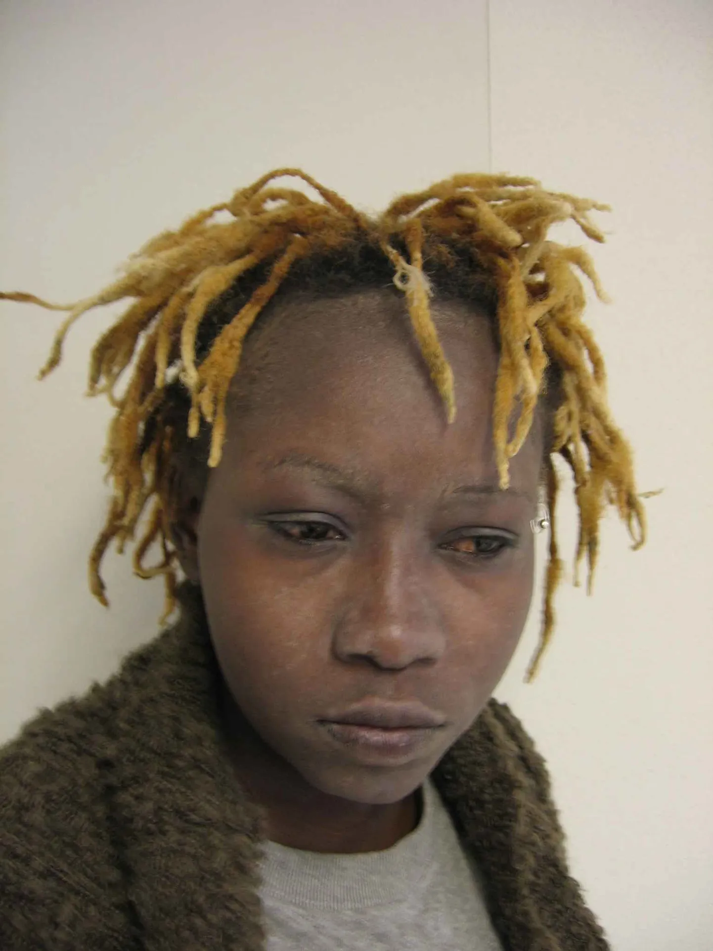 HIV-positiivne Judith Omondi-Mäkelä