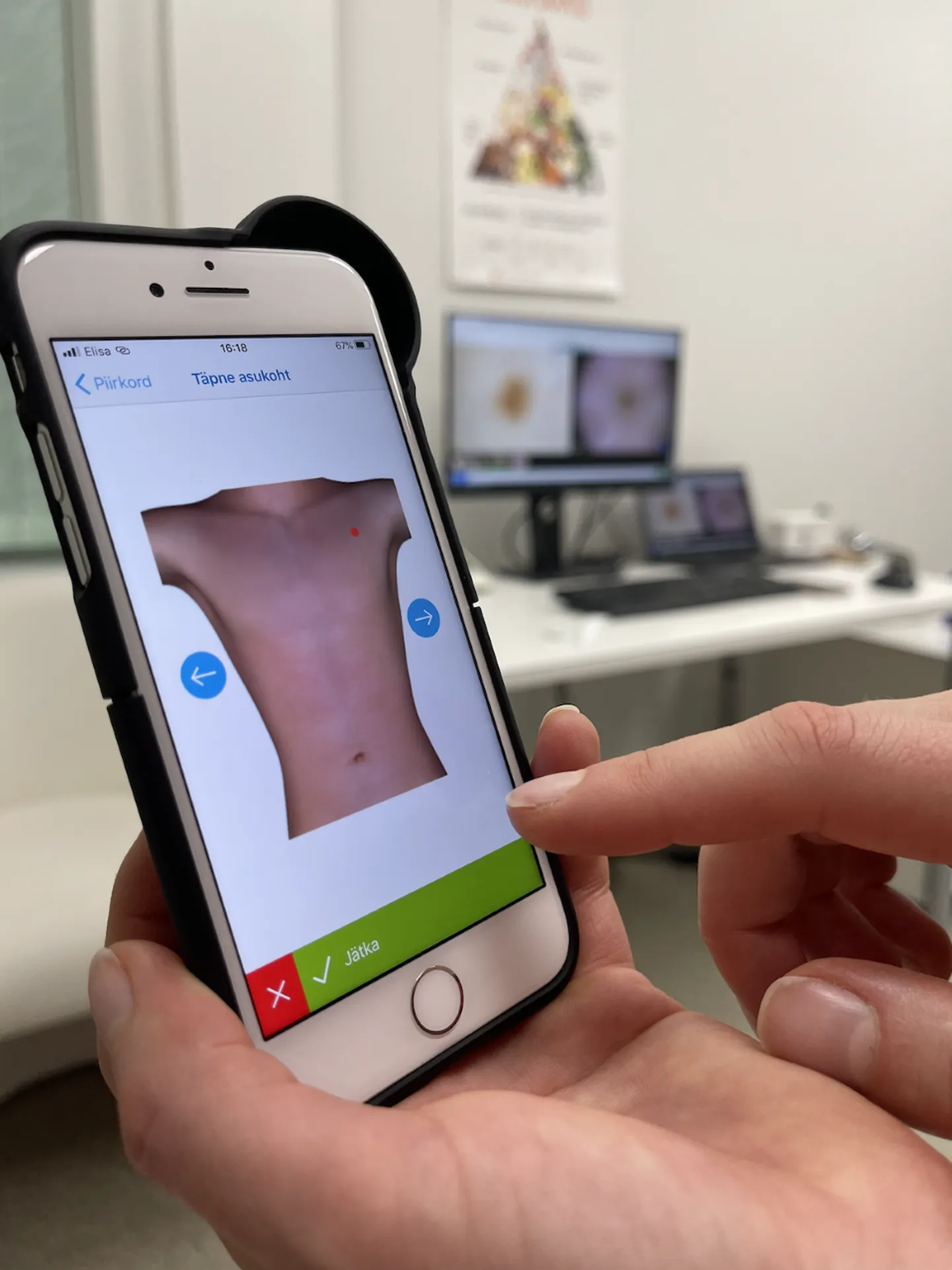 Eesti meditsiinitarkvara Dermtest pakub digitaalseid tööriistu nahaga seotud haiguste käsitlemiseks.