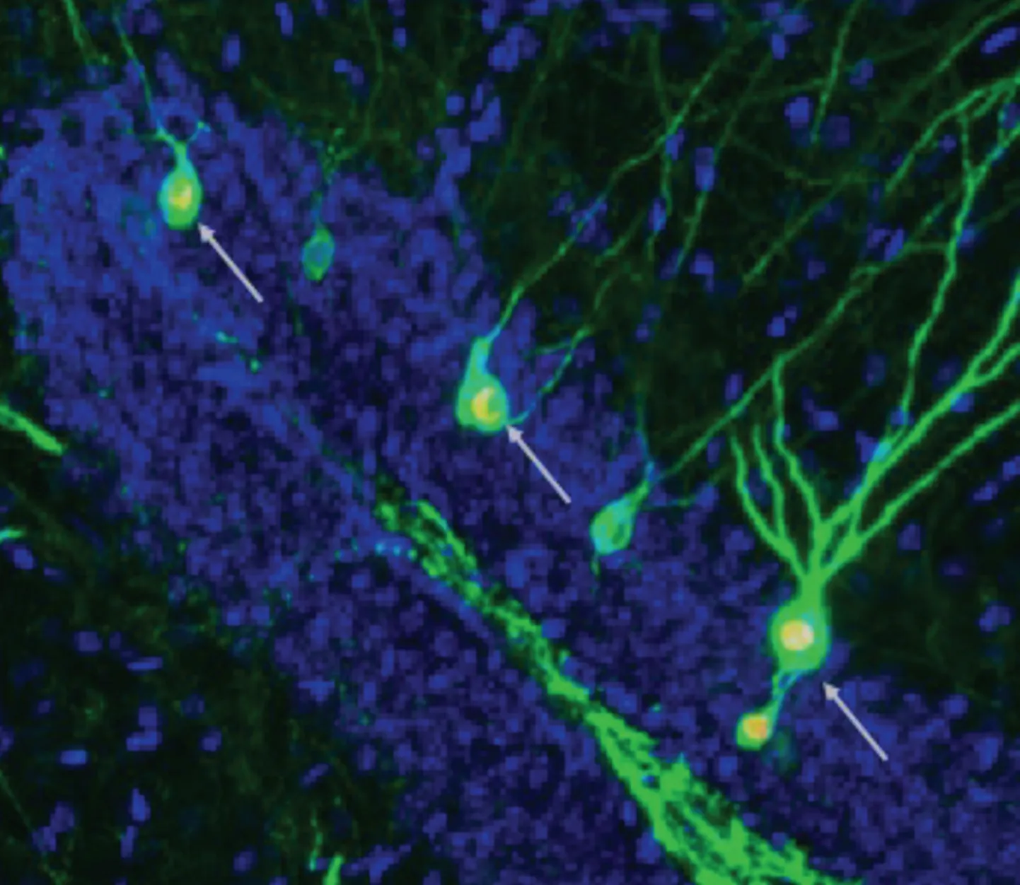 Uuring näitab, et neurogeneesi suurendamine suurendab ka äsja moodustunud neuronite arvu, mis on seotud mälestuste (nooltega näidatud) salvestamisega ja meenutamisega Alzheimeri tõvega hiirte hipokampuses.