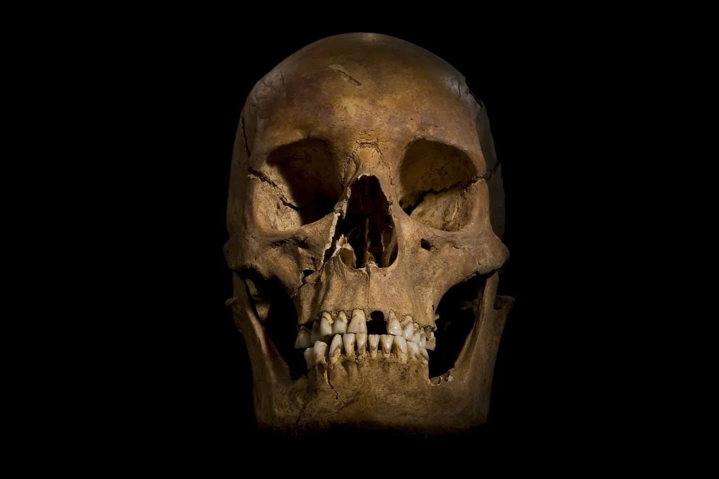 Richard III kolju