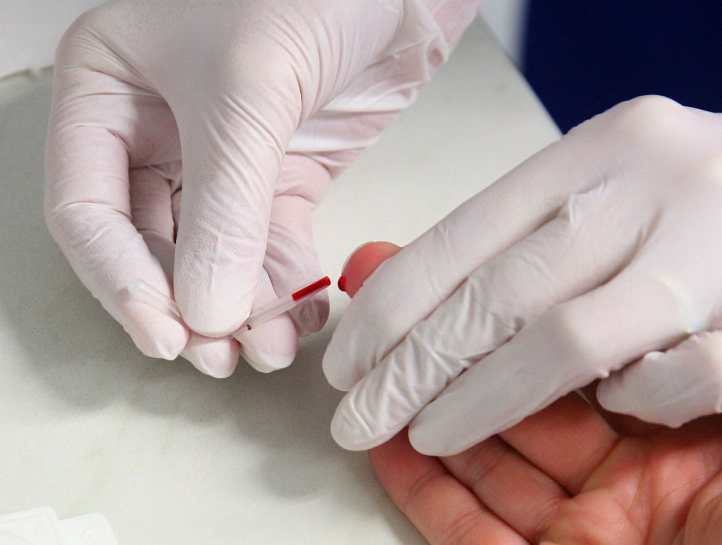 HIV-kiirtestid aitavad haiguse levikut piirata ja inimesel õigel ajal abi saada.