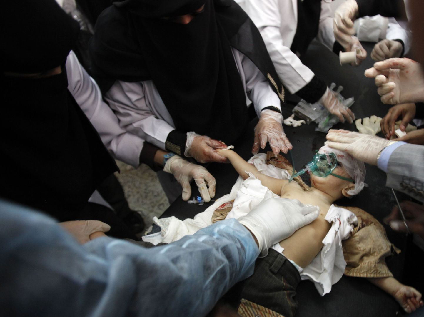 Jeemeni pealinna Sanaa haiglas leidis aset tulistamisintsident