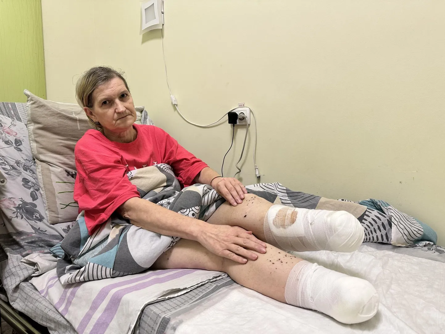 Tamila Solodkova jäi peale droonirünnakut ilma mõlemast jalast altpoolt põlve.