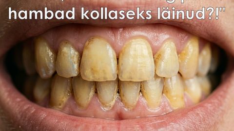Kollased hambad