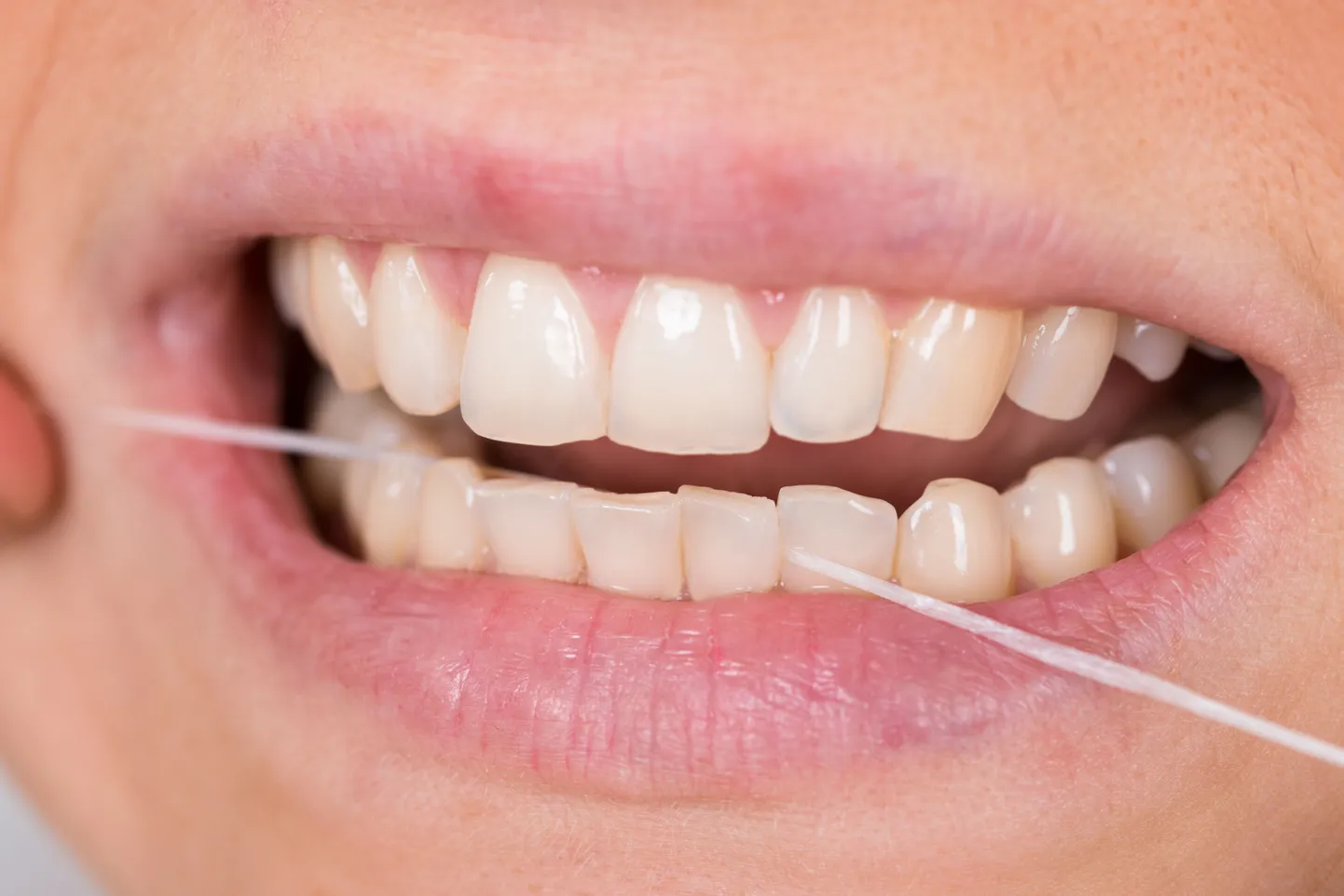 Hambaniit on vajalik, sest hambahari ei jõua igale poole.