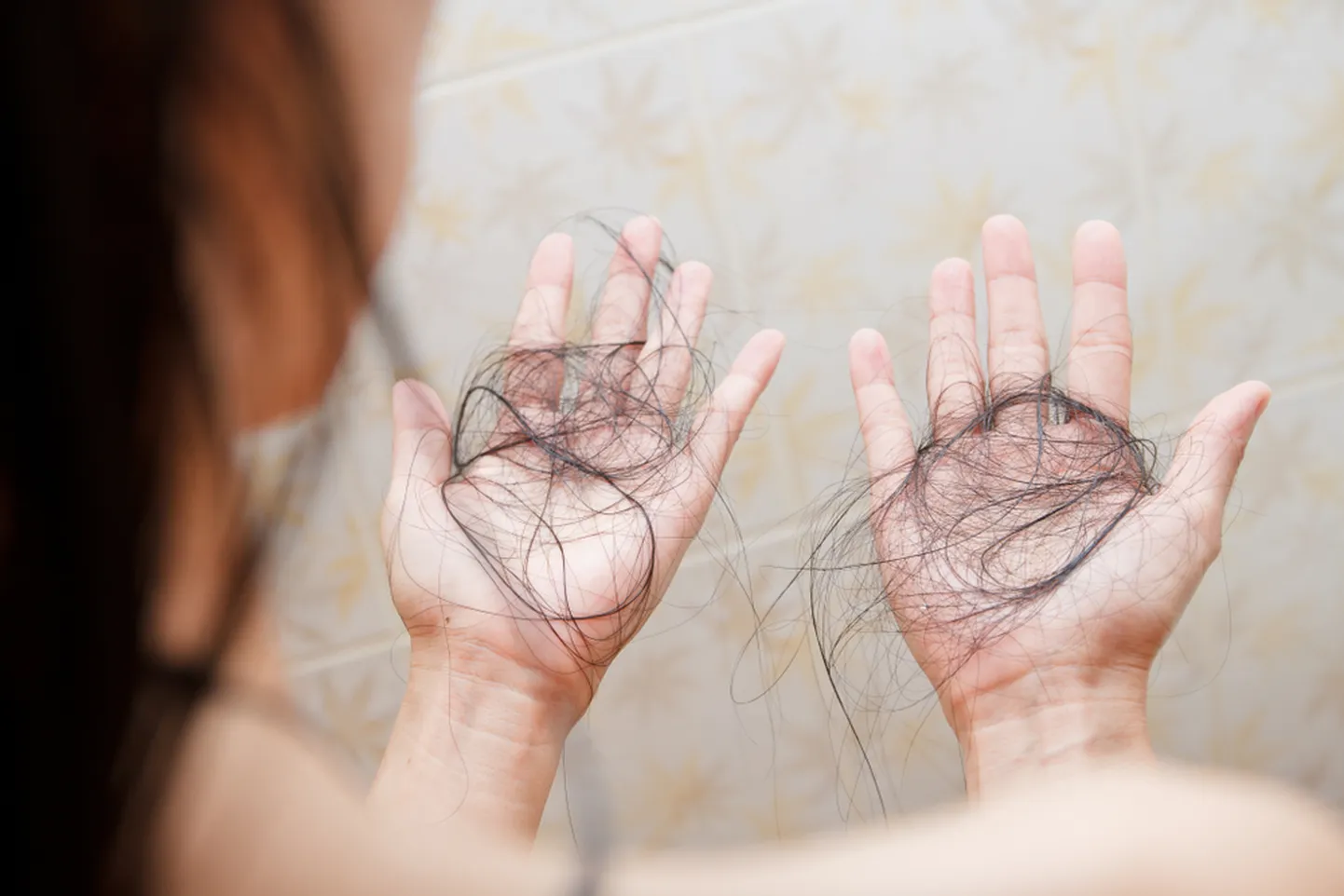Hair falling out in two hands after rinse off shampoo.